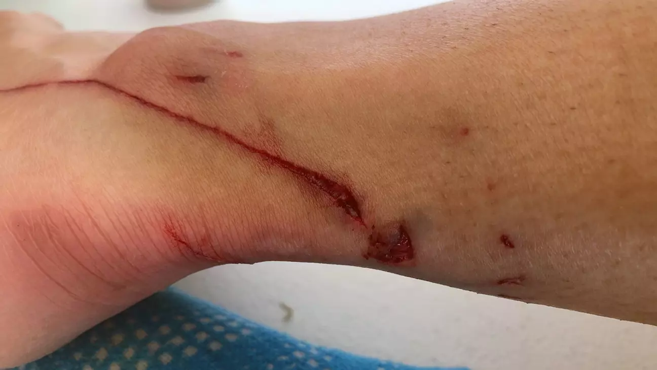 Lily Tomasula-Martin leg