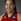 Schimmel, Shoni