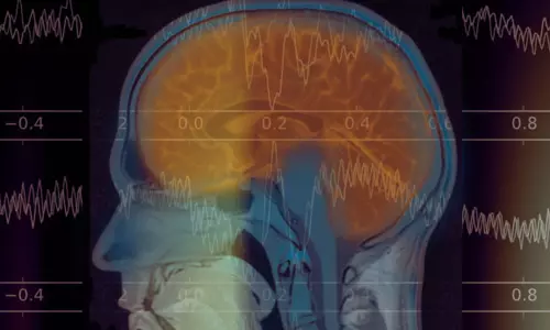 UD Student-Athletes Participating in Landmark Concussion Study