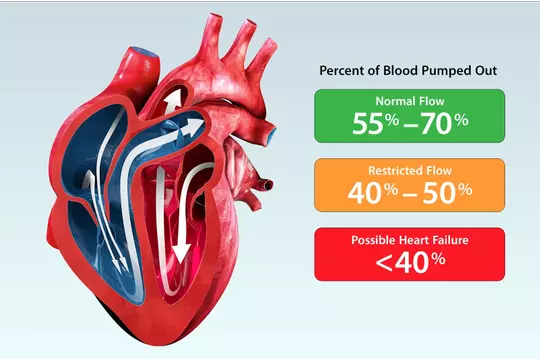 Heart Ejection Fraction Chart