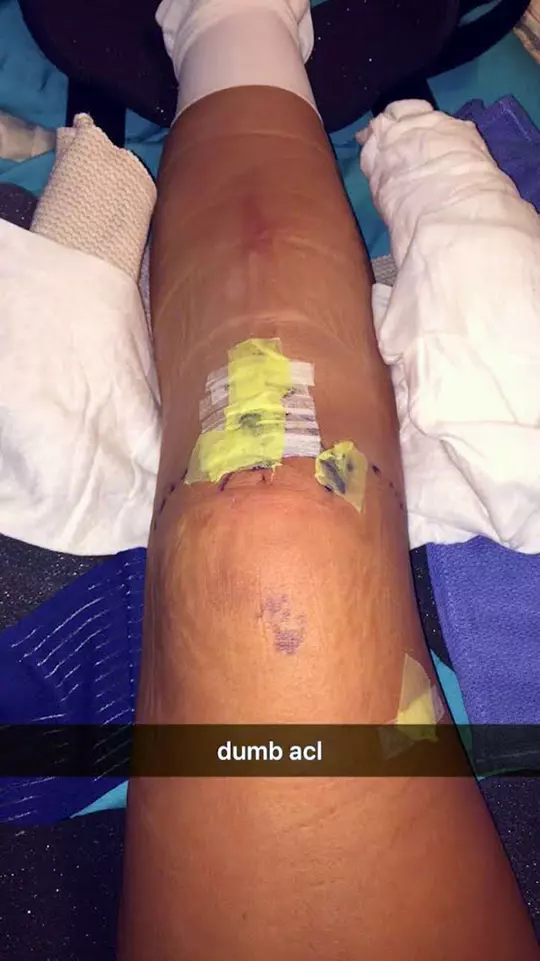 Taylor Whitmer torn ACL