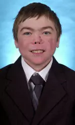 Men's Golf Team Manager Loses Battle With Rare Disease