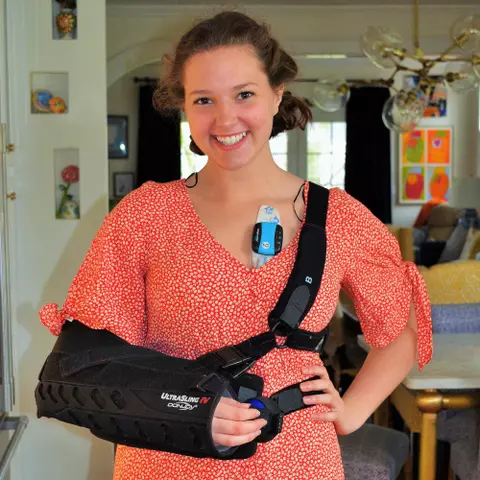 Person With Arm In Cast Standing